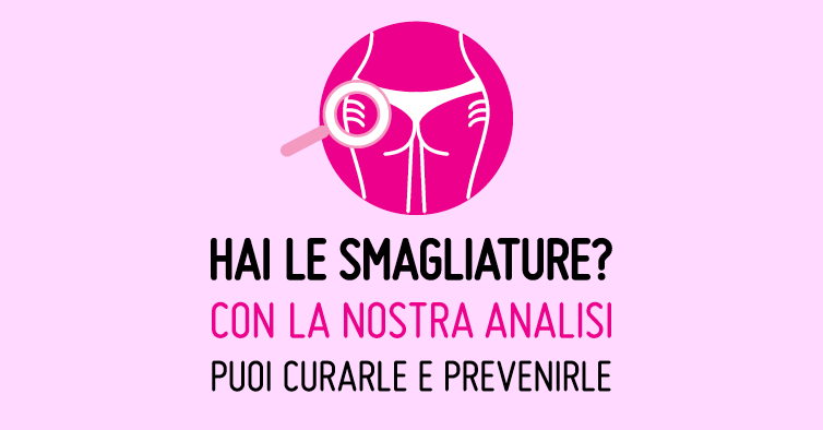 Curare e prevenire le smagliature